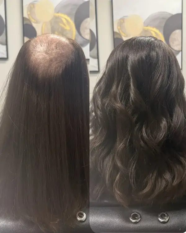 Antes y después de una prótesis femenina de cabello largo: coronilla despoblada y después con el cabello completo y ondulado